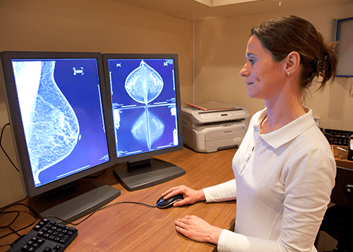 Detección de cancer de mama