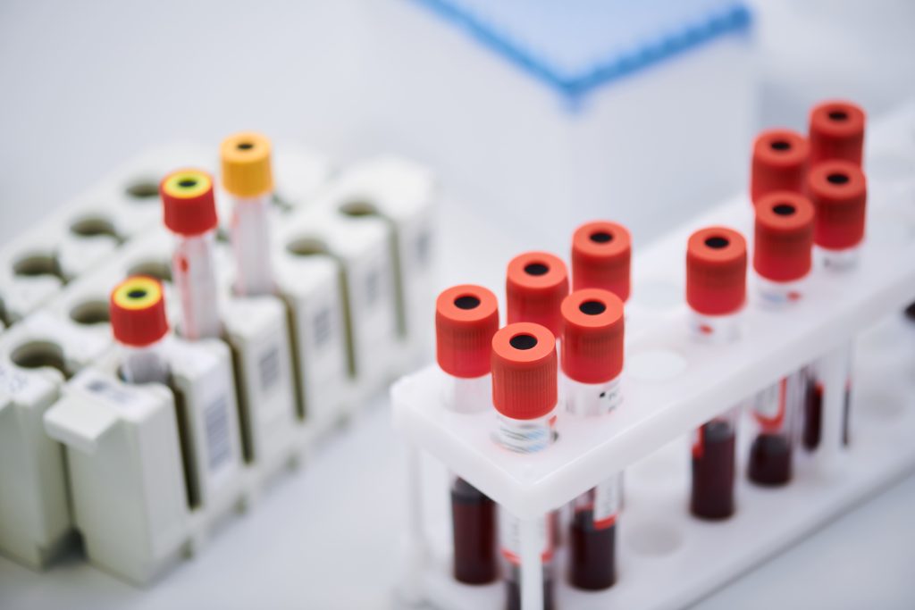 Imagen de tubos de recogida de muestras de sangre