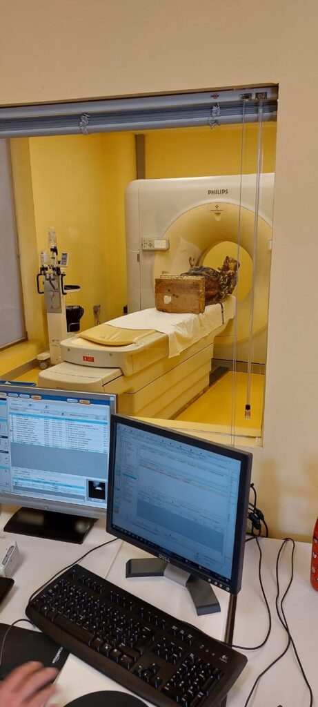 Las máquinas del TAC de Centro de Diagnóstico Granada han recibido una talla de una virgen con más de 300 para ayudar en su proceso de restauración.