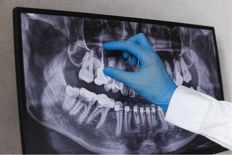 Imagen de un profesional de la medicina revisando una radiografía dental.